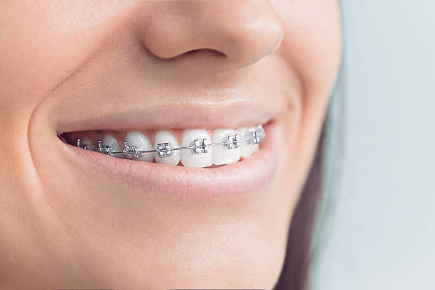 Best Invisalign and Clear Aligners  in Blackhawk, SD